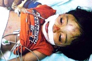 Ребёнок после бомбардировки