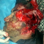 Лицо ливийца, замученного боевиками Аль-Каиды. Его вина было только в том, что он отказался участвовать в сжигании национального зеленого ливийского флага