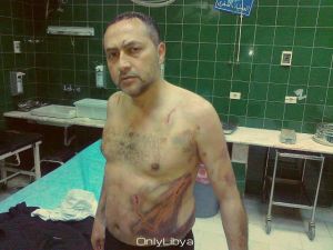 Боевики ПНС жестоко избили доктора Хишам, им показалось, что он плохо лечит раненных, они не понимают, что на качество лечения в первую очередь влияет нехватка лекарств, расходных материалов и оборудования. Боевики ПНС жестоко …