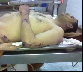 Злитен: Боевики ПНС забили до смерти врача из больницы Злитена Омара Хусейна Фарадея, после того как он сказал, что не в состоянии выполнять операции мятежникам, раненным при грабеже. Злитен: Боевики ПНС …