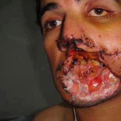 Фото человека, которого пытали в застенках натофашистов в Ливии. Фото человека, котор…