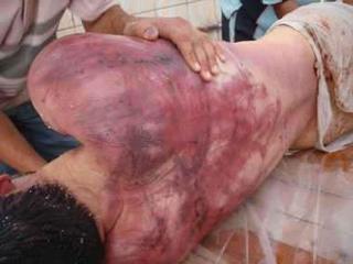 Жестокие истязания боевиками НАТО/ПНС арестованных граждан Ливии Жестокие истязания б…