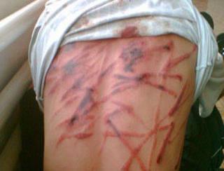 Жестокие истязания боевиками НАТО/ПНС арестованных граждан Ливии Жестокие истязания б…