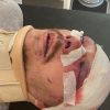 Блогера Анатолия Шария неонацисты пообещали убить